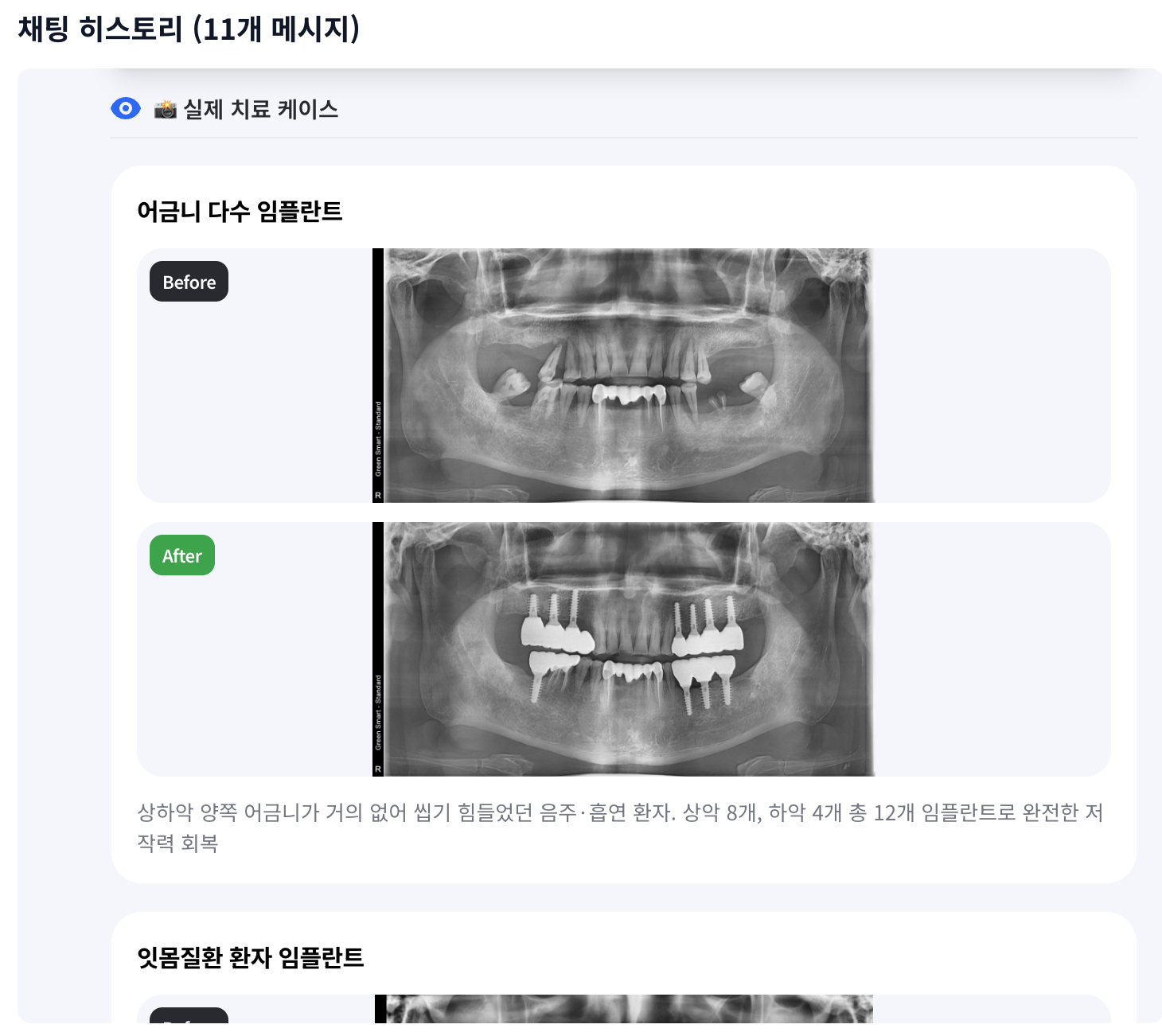 AI 상담 대화 안에서 실제 치료 케이스를 함께 보여주는 화면 예시